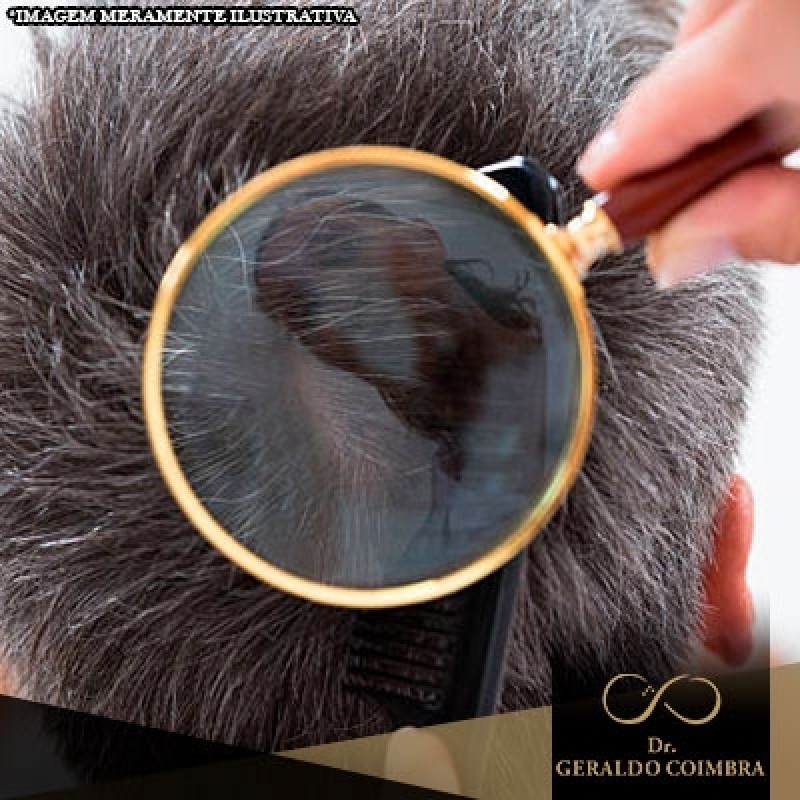 Clínica com Tratamento Capilar Masculino Perdizes - Tratamento Capilar Barba